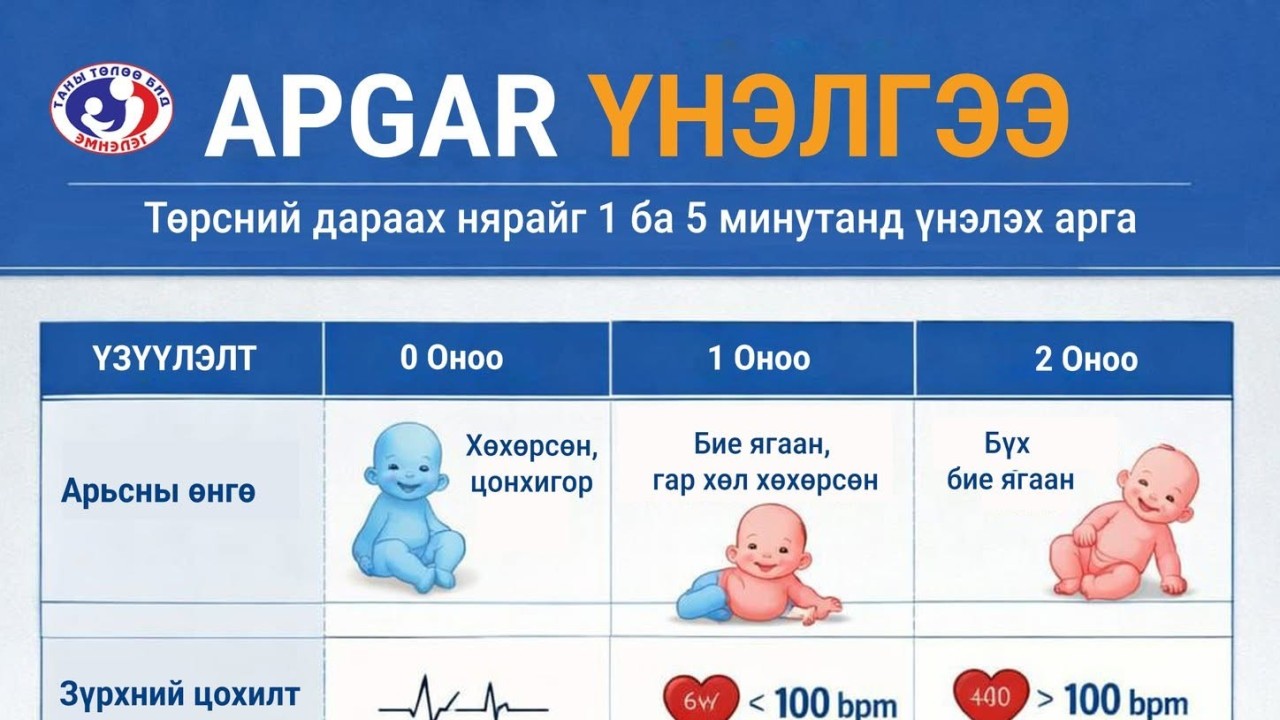 Apgar үнэлгээ гэж юу вэ?