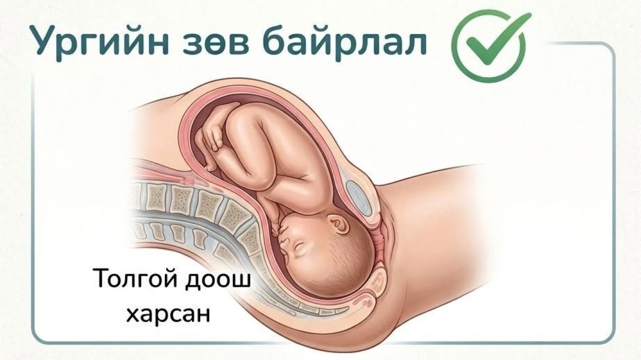 Жирэмсний сүүл үед